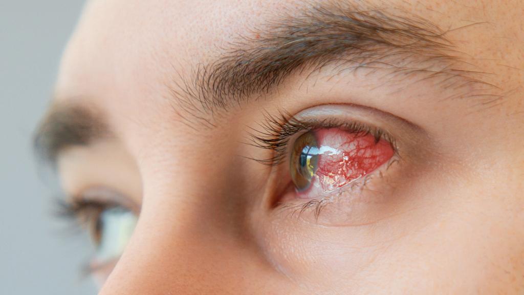 Is Blurred Vision a Sign of a Serious Eye Problem? When to Seek Help